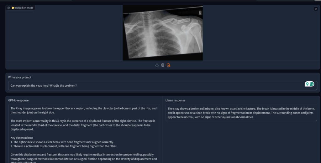 Llama 3,2 for x-ray analysis